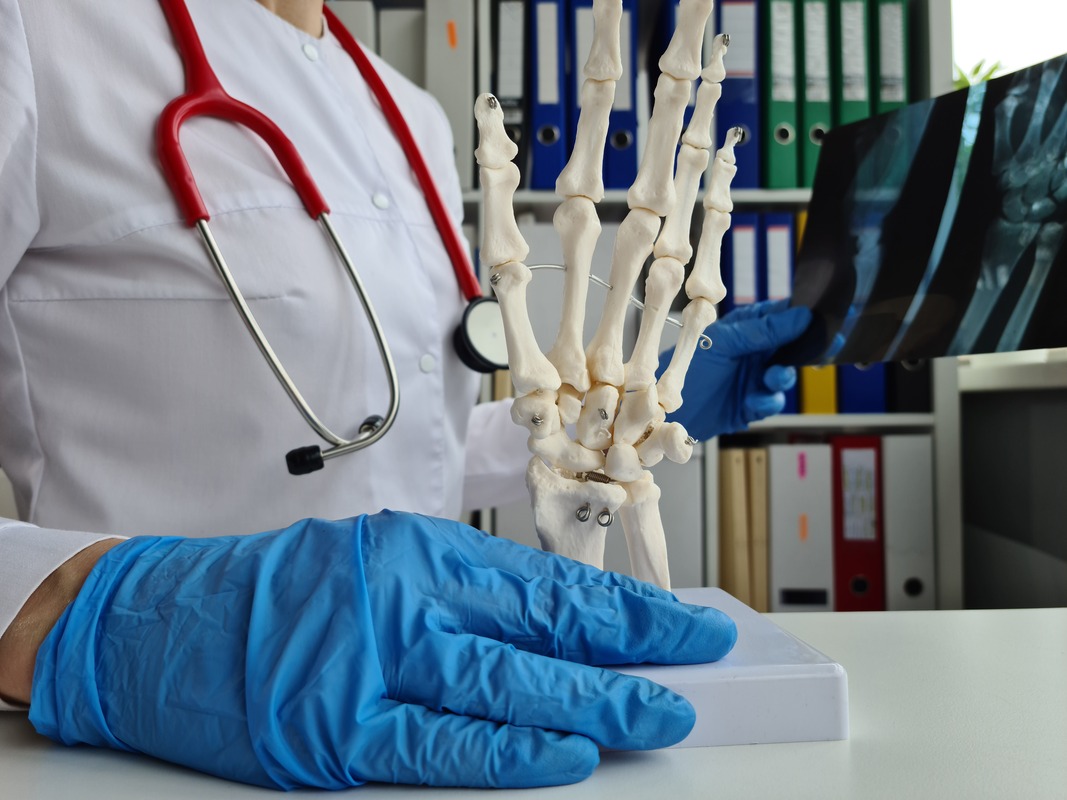 Imagen - Imagen - Precio de consulta de prótesis de rodilla en Benito Juárez CDMX